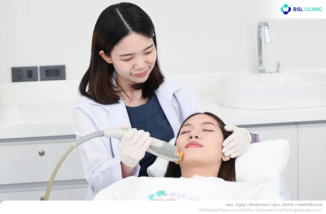 melasma-โปรแกรมเลเซอร์รักษาฝ้าเส้นเลือด-610209-A