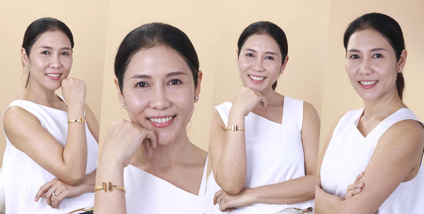 รีวิวคนไข้จริง 1 รีวิว รักษาฝ้าที่คลินิกไหนดี