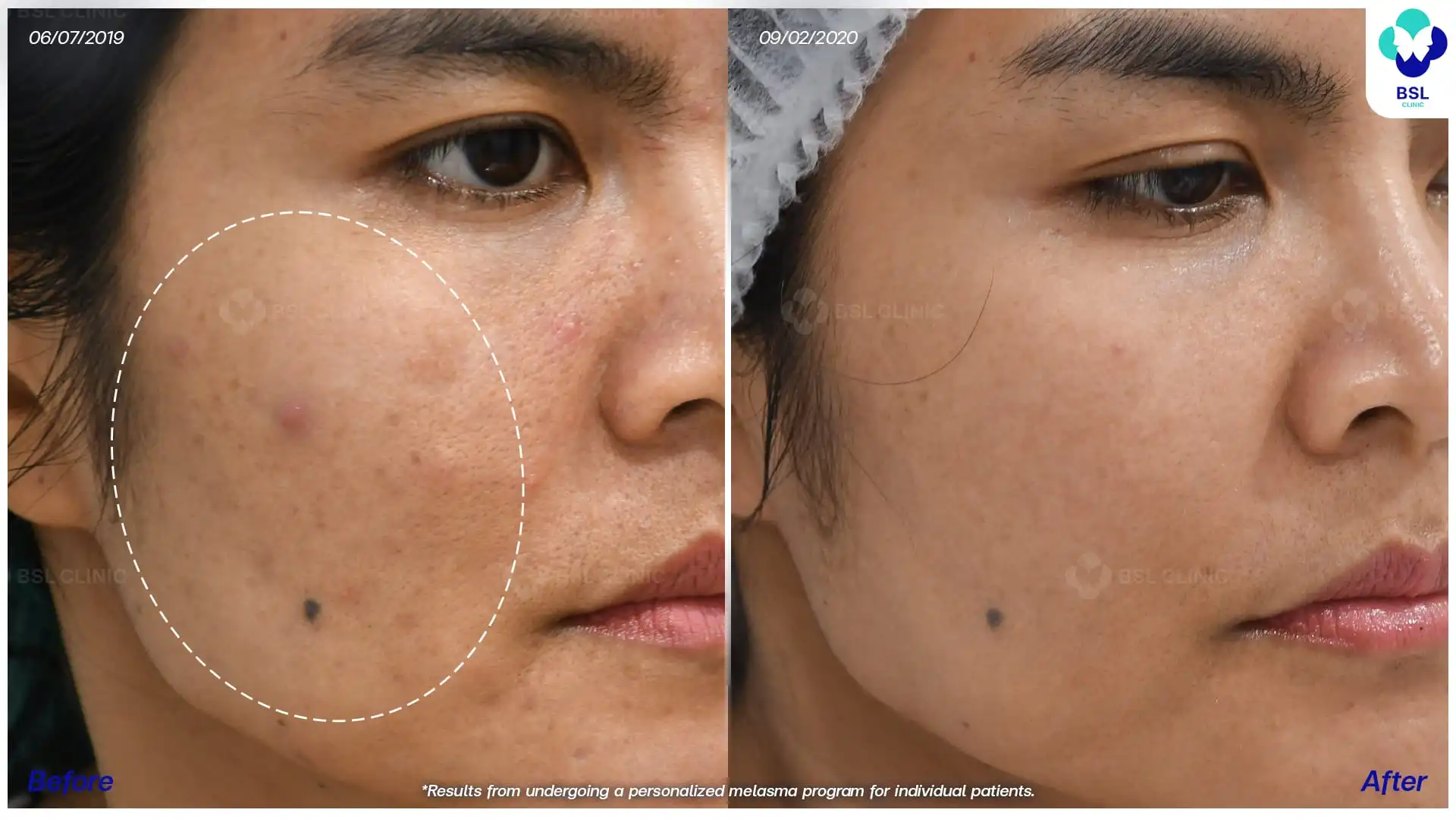 ฝ้า 620269 A นุชรินทร์ เพ็งสวัสดิ์ 03psd