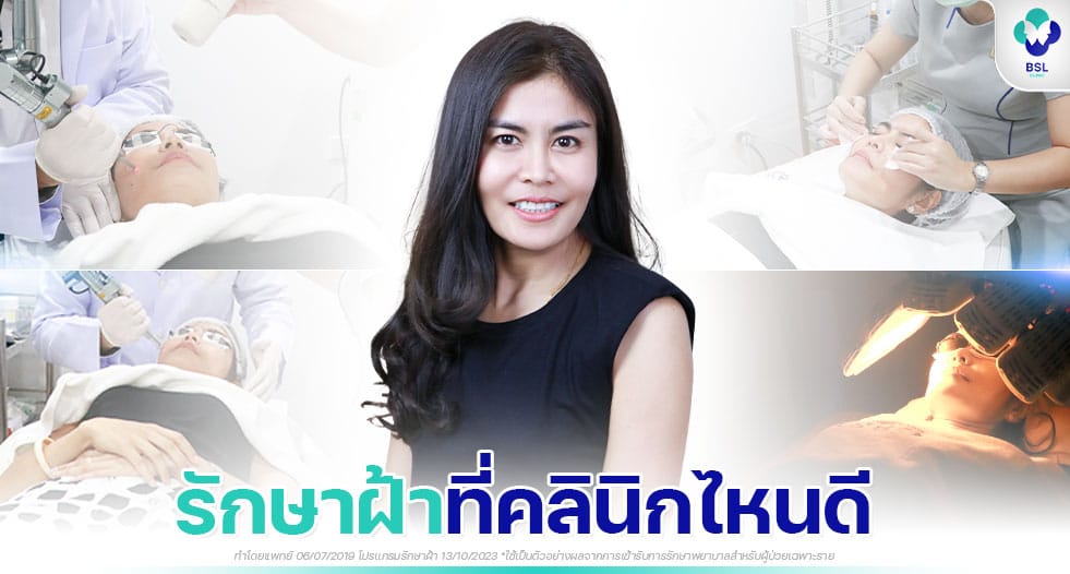 เปิดใจรีวิวรักษาฝ้า จากผู้ใช้บริการที่อยากรู้จัก BSL ให้เร็วกว่านี้ 1 รักษาฝ้าที่คลินิกไหนดี