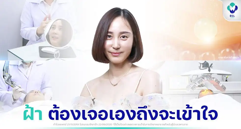 หน้าเป็นฝ้า