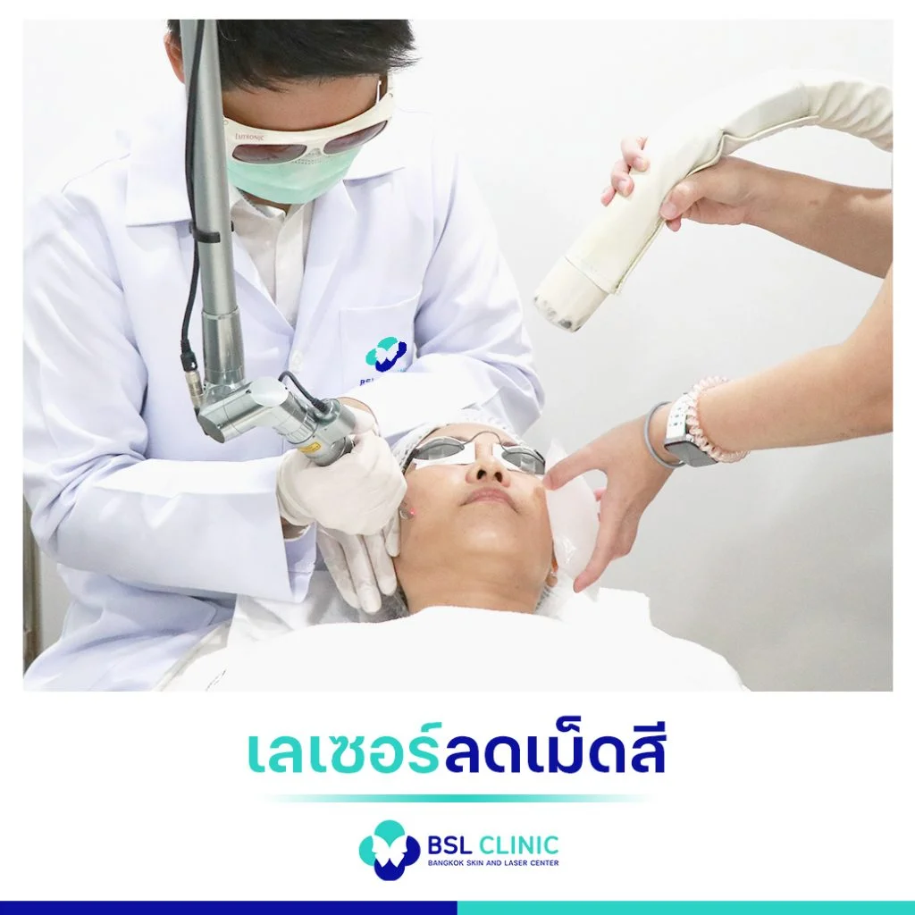 6 ขั้นตอน วิธีรักษาฝ้า เลือกแบบที่ใช่ ตรงกับปัญหาฝ้าของคุณ 2 วิธีรักษาฝ้า เลเซอร์ลดเม็ดสี