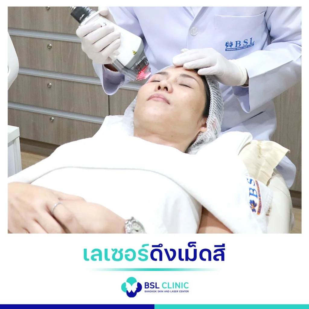 6 ขั้นตอน วิธีรักษาฝ้า เลือกแบบที่ใช่ ตรงกับปัญหาฝ้าของคุณ 3 วิธีรักษาฝ้า เลเซอร์ดึงเม็ดสี