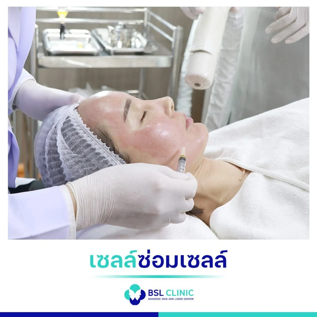 6 ขั้นตอน วิธีรักษาฝ้า เลือกแบบที่ใช่ ตรงกับปัญหาฝ้าของคุณ 6 วิธีการรักษาฝ้า เซลล์ซ่อมเซลล์