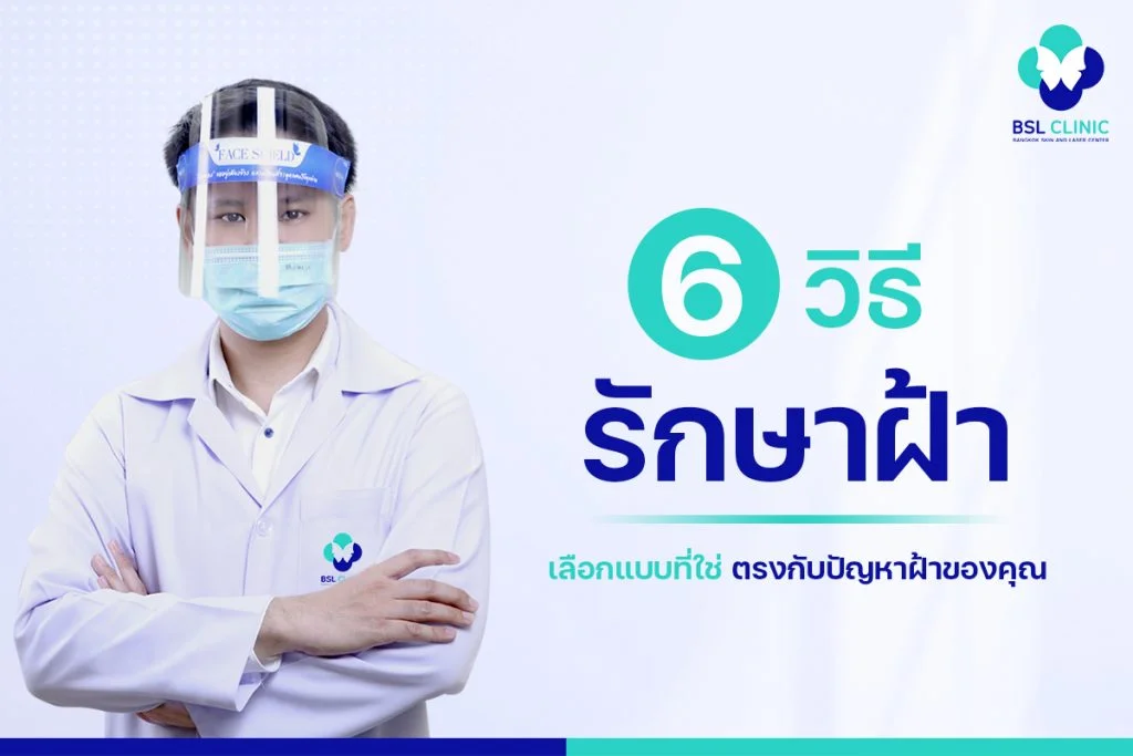 6 ขั้นตอน วิธีรักษาฝ้า เลือกแบบที่ใช่ ตรงกับปัญหาฝ้าของคุณ 1 วิธีรักษาฝ้า