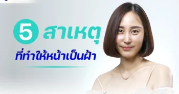 หน้าเป็นฝ้า