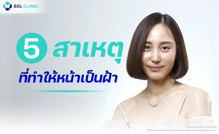 หน้าเป็นฝ้า