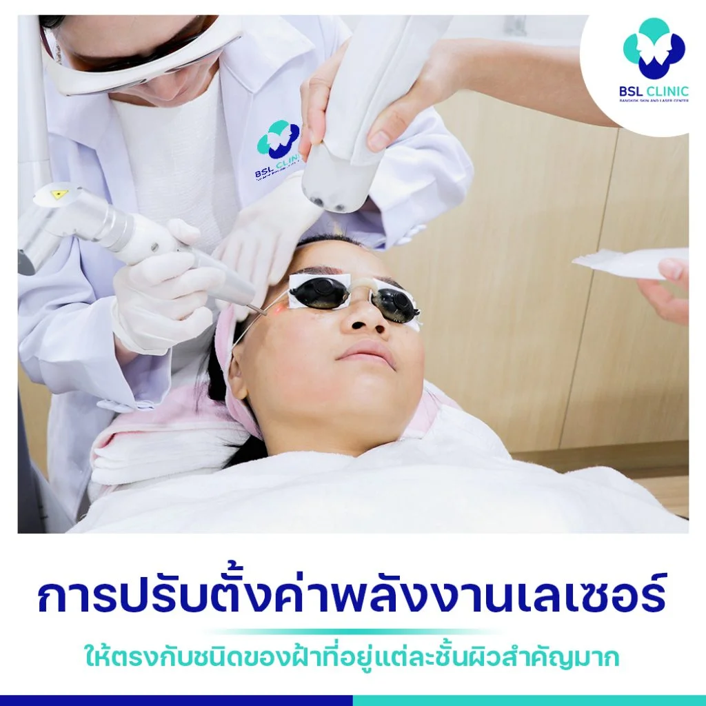 BSL Clinic เราเชี่ยวชาญในการตั้งค่าพลังงานเลเซอร์รักษาฝ้า 4 รักษาฝ้า-ด้วยเลเซอร์ลดเม็ดสี