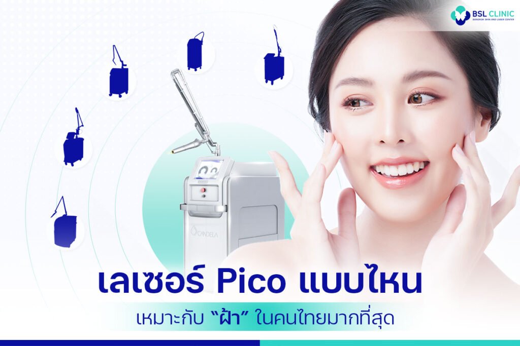2เลือก-Pico-Laser-แบบไหน-ให้เหมาะกับ-“ฝ้า”-ในคนไทยมากที่สุด