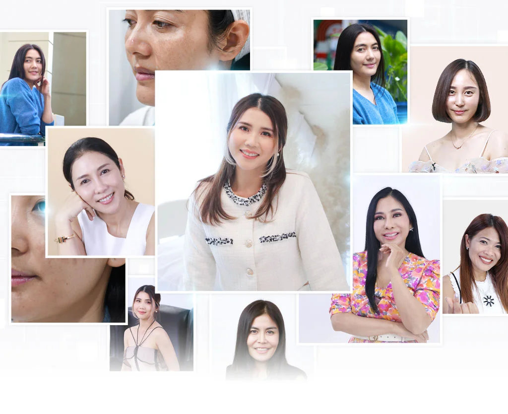 ผลการรักษา 2 3mbanner รีวิวผลการรักษาฝ้า