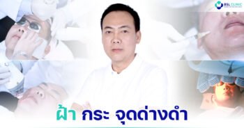 เรื่องราวของคนไข้-รีวิวรักษาฝ้าแดด-คุณพีระ