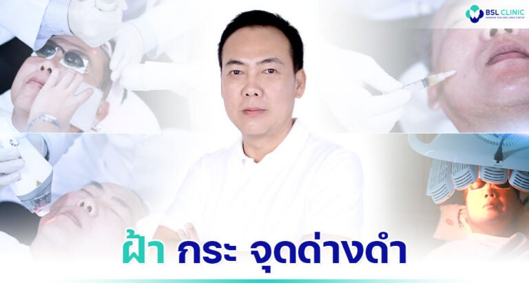 เรื่องราวของคนไข้-รีวิวรักษาฝ้าแดด-คุณพีระ
