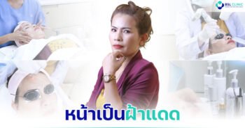 ผิวหมองคล้ำ-หน้าเป็นฝ้าแดด