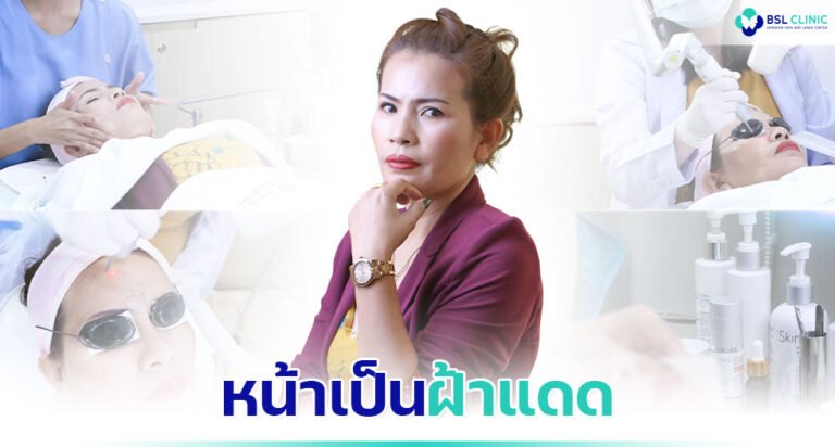 ผิวหมองคล้ำ-หน้าเป็นฝ้าแดด