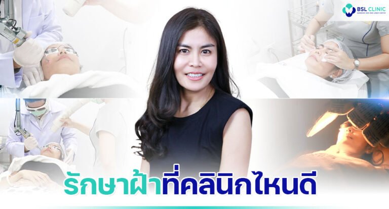 รักษาฝ้าที่คลินิกไหนดี