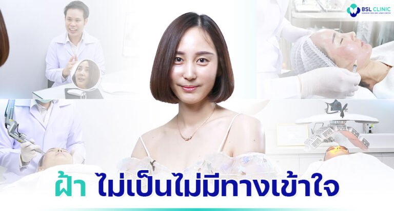 รักษาฝ้าที่เกาหลีแต่ไม่เห็นผล จนกลับมาเลซอร์ ฝ้า กระ ที่ไทย