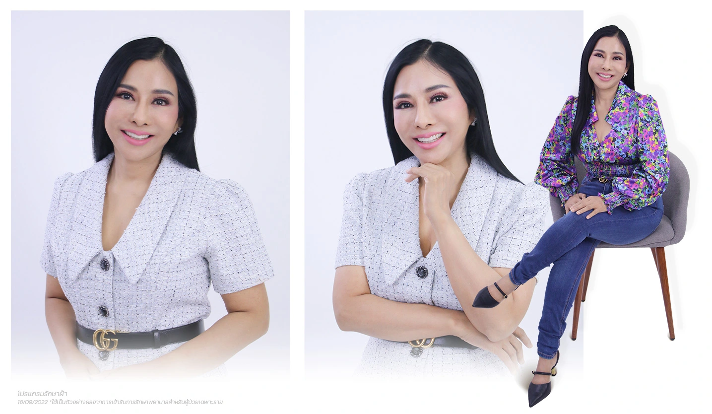 Working woman แชร์แนวคิด “คิดอย่างเดียวไม่ได้ ต้องลงมือทำ” สู่ความสำเร็จ ผู้บริหารธุรกิจอสังหาริมทรัพย์ 1 the-passion-คนไข้-รักษาฝ้า-คุณรัก