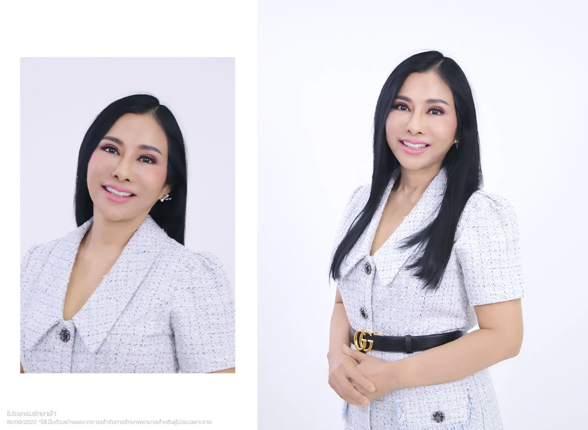 Working woman แชร์แนวคิด “คิดอย่างเดียวไม่ได้ ต้องลงมือทำ” สู่ความสำเร็จ ผู้บริหารธุรกิจอสังหาริมทรัพย์ 13 รักษาฝ้า