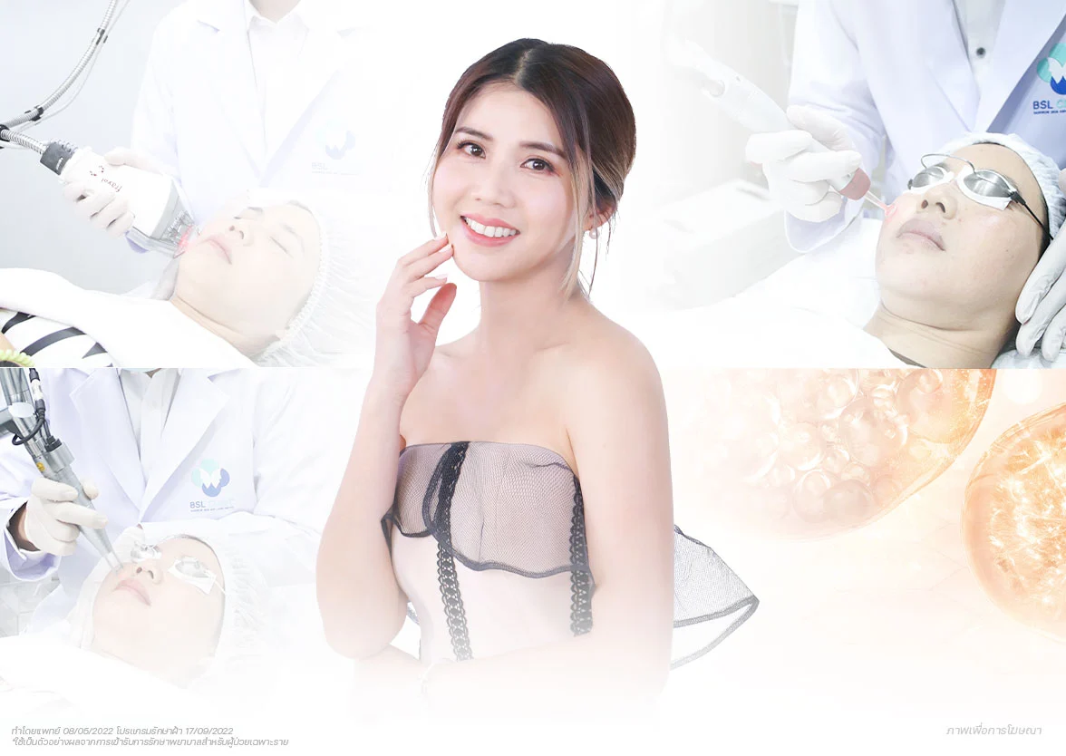 รักษาฝ้า