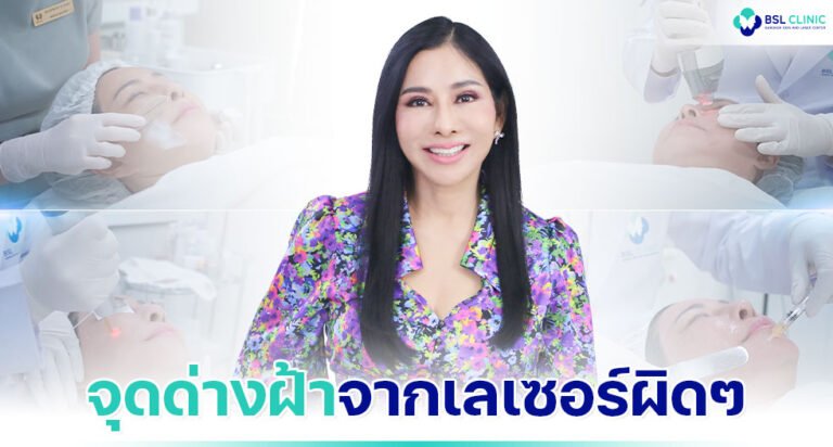 รีวิวรักษาฝ้า-แบบเปิดใจ-เลเซอร์ฝ้า