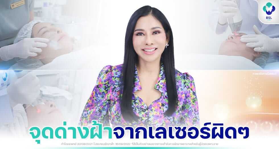 รีวิวรักษาฝ้า แบบเปิดใจ เลเซอร์ฝ้า