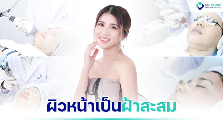 เคล็ดลับ-“รักษาฝ้า”-เป็นสาวหน้าใส-ที่ใครจะเชื่อว่าอายุใกล้เลข-4