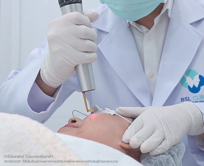 รีวิวรักษาฝ้า ถ้ารู้จัก BSL Clinic ตั้งแต่แรก ก็คงดี 8 ลบเม็ดสีฝ้า 1
