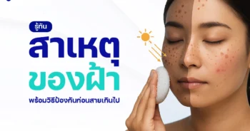 สาเหตุของฝ้า