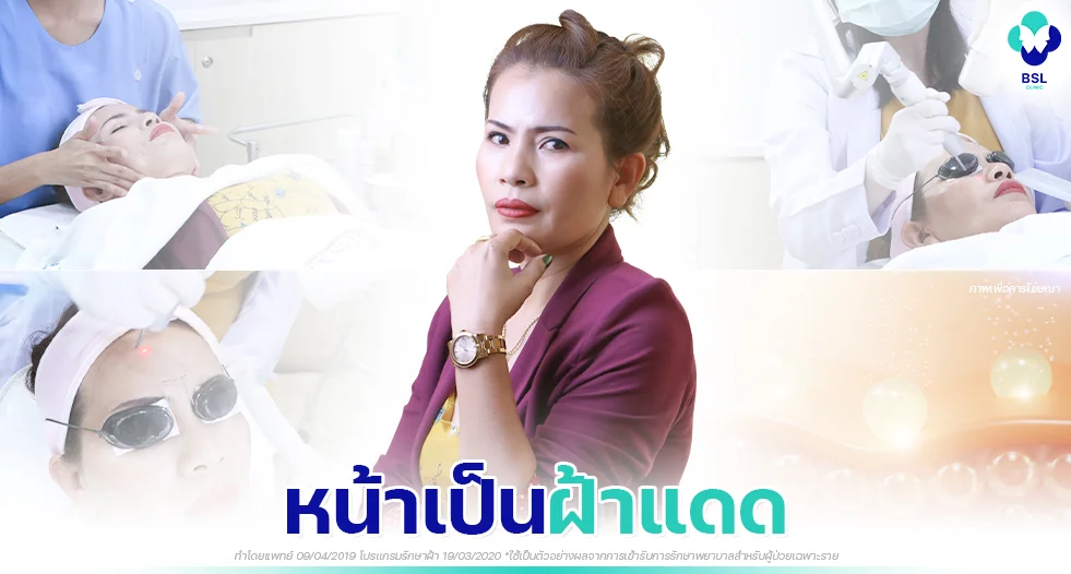 ผิวหมองคล้ำ