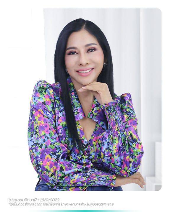 รีวิวรักษาฝ้าที่ BSL Clinic
