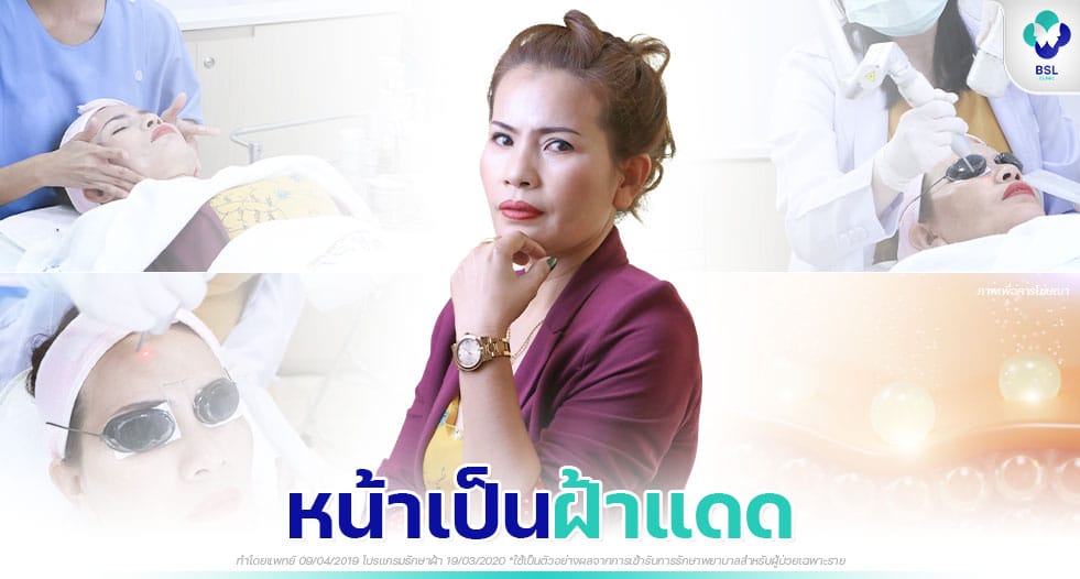 ผิวหมองคล้ำ หน้าเป็นฝ้าแดด