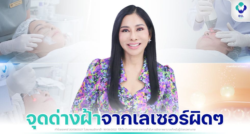 รีวิวรักษาฝ้า แบบเปิดใจเลเซอร์ฝ้า คุณรัก