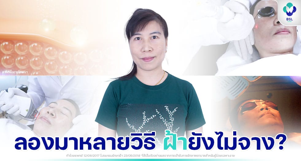 โปรแกรมรักษาฝ้า