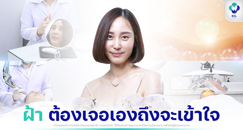 หน้าเป็นฝ้า
