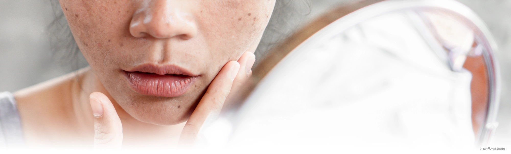 banner-เกร็ดความรู้-เรื่องฝ้า-ดูแล-รักษาฝ้า-edit-02