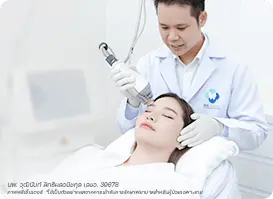 เลเซอร์ฝ้า